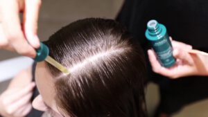 Min bästa kur för hårproblem: Behandling för hårbotten och allt du behöver veta om det